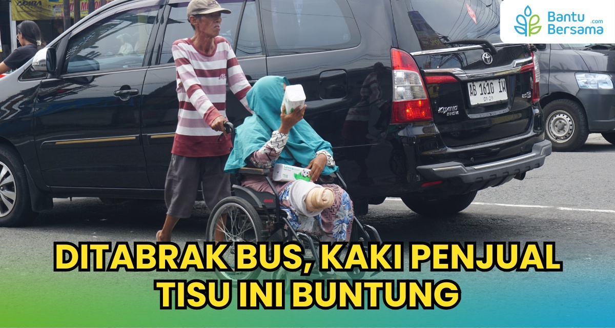 Ditabrak Bus Kaki Penjual Tisu Ini Buntung