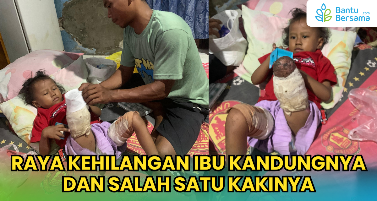 Raya Kehilangan Ibu Kandungnya Dan Salah Satu Kakinya