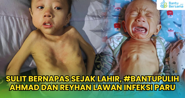 Sulit Bernapas Sejak Lahir, #BantuPulih Ahmad & Reyhan Lawan Infeksi Paru