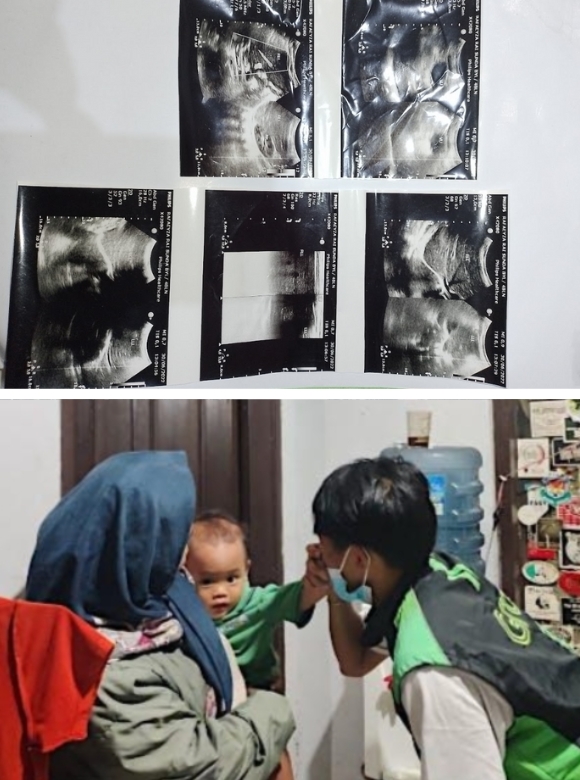 Ojol Butuh Ratusan Juta Tuk Selamatkan Istri Dan Anaknya! - Bantubersama.com