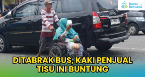 Ditabrak Bus Kaki Penjual Tisu Ini Buntung
