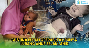 Gustina Butuh Operasi,Tak Punya Lubang Anus Sejak Lahir